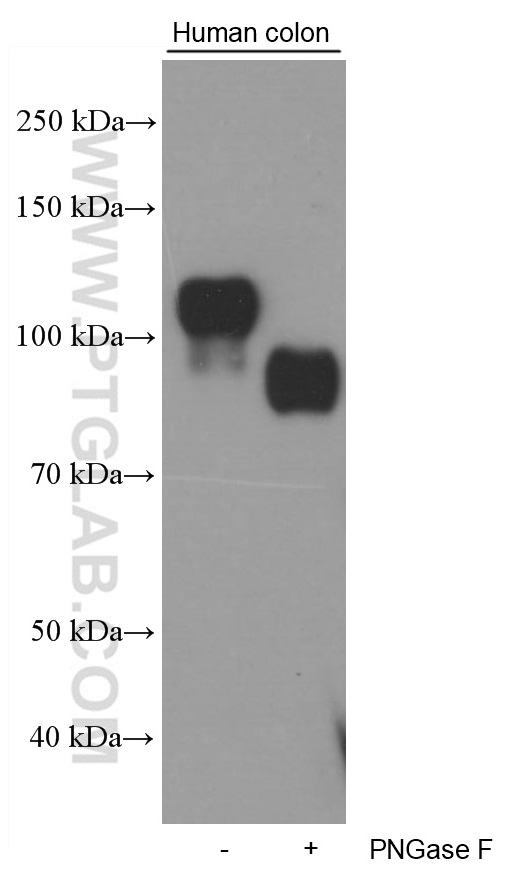 WB analysis of human colon using 60351-1-Ig (same clone as 60351-1-PBS)
