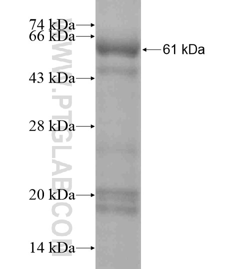 CDH17 fusion protein Ag19414 SDS-PAGE CDH17 fusion protein Ag19414 SDS-PAGE