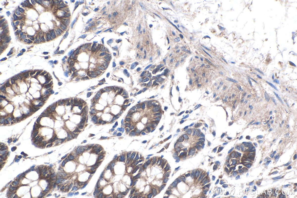 IHC staining of human colon using 22049-1-AP