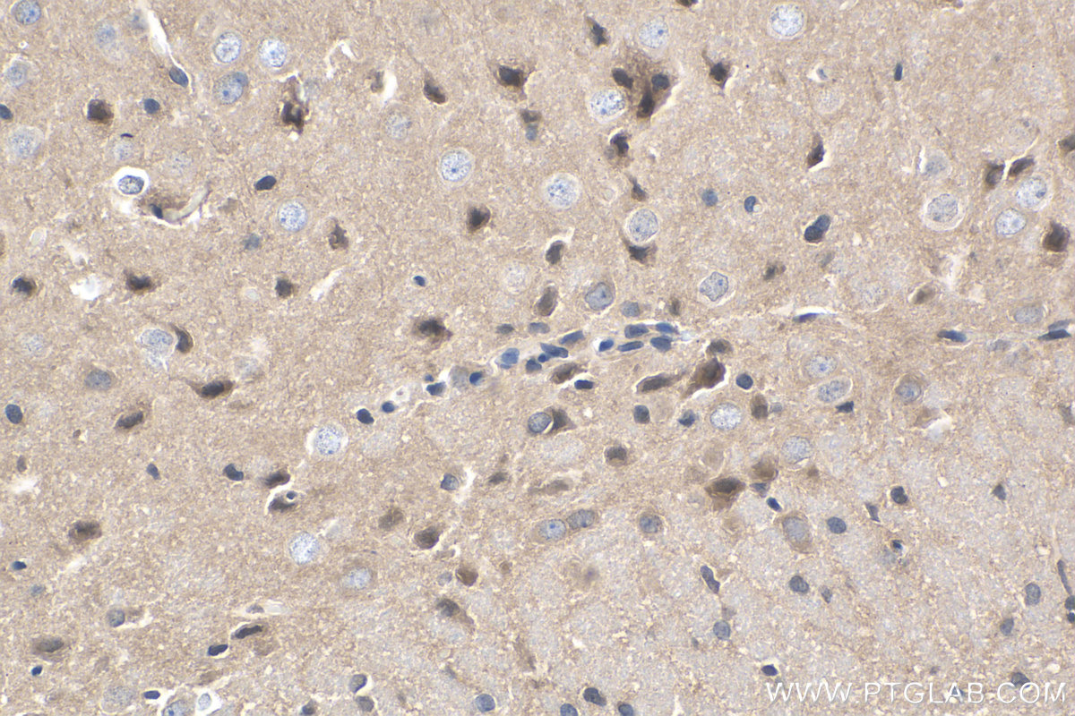 IHC staining of rat brain using 22049-1-AP