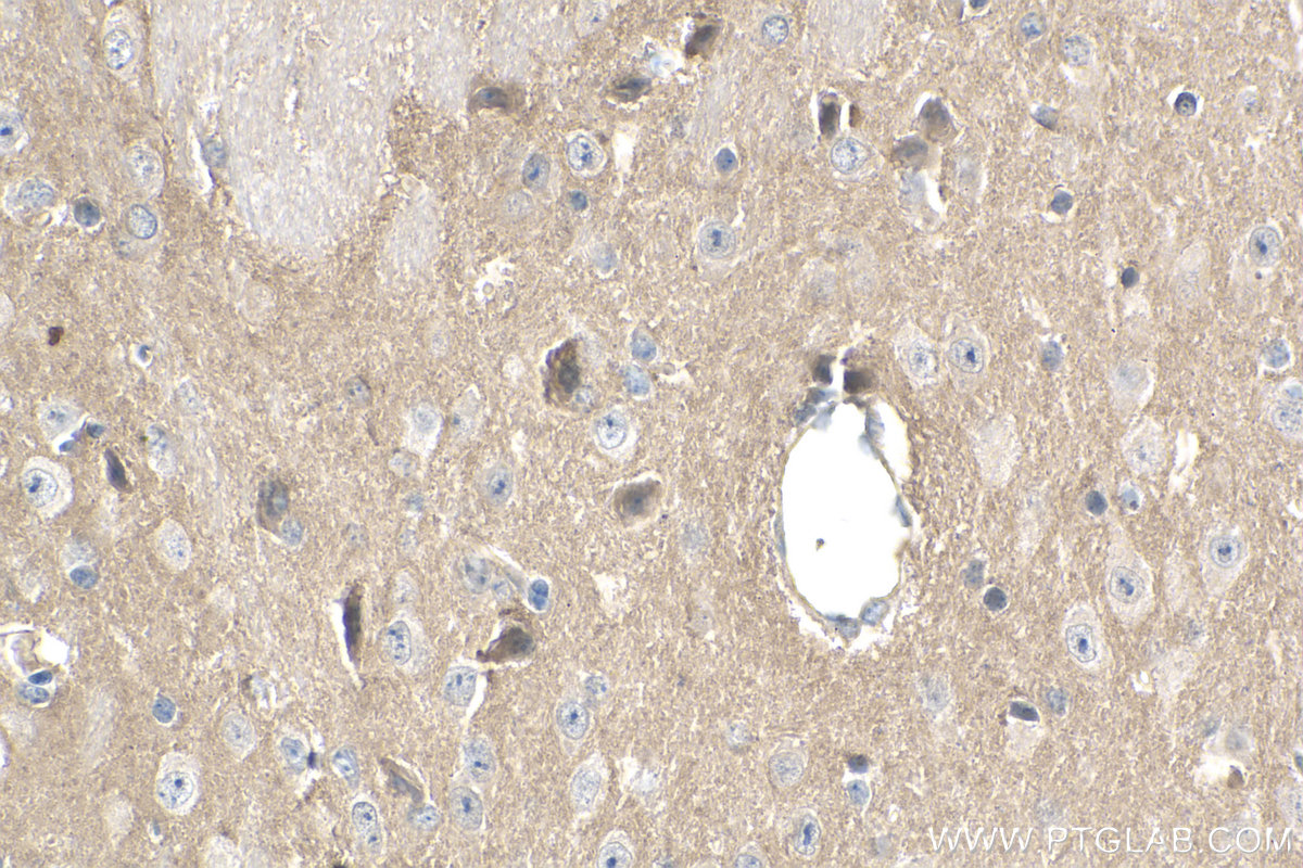 IHC staining of mouse brain using 22049-1-AP