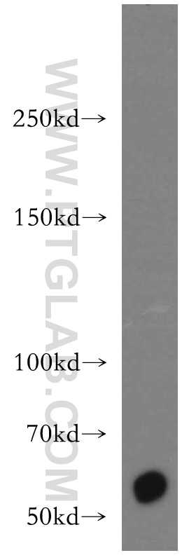 WB analysis of A431 using 13496-1-AP