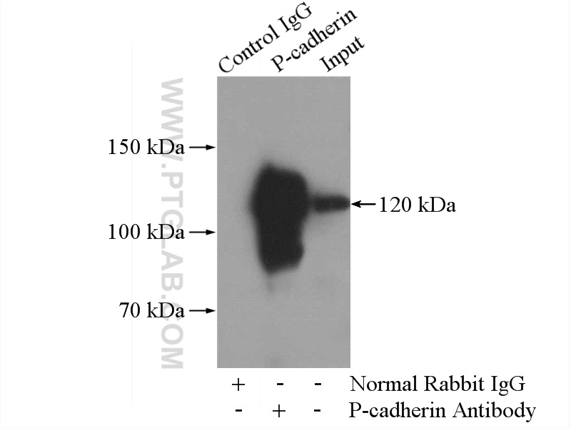 IP experiment of A431 using 13773-1-AP