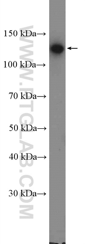 WB analysis of A431 using 13773-1-AP