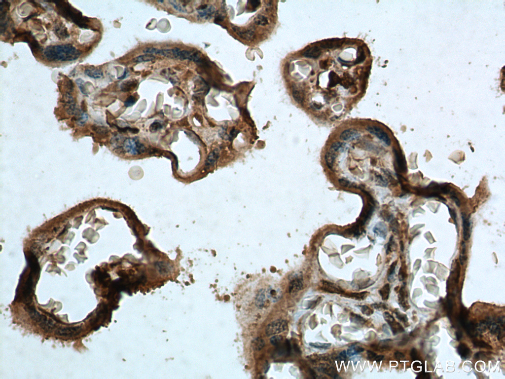 IHC staining of human placenta using 66295-1-Ig