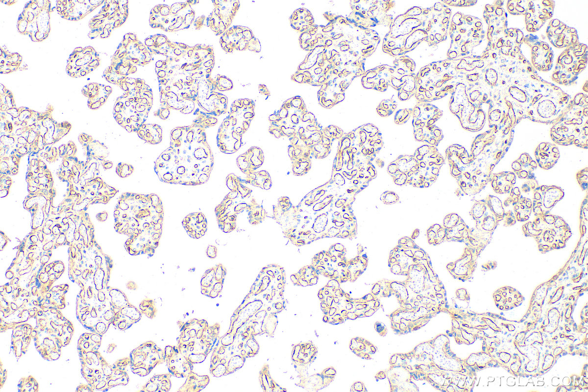 IHC staining of human placenta using 27956-1-AP