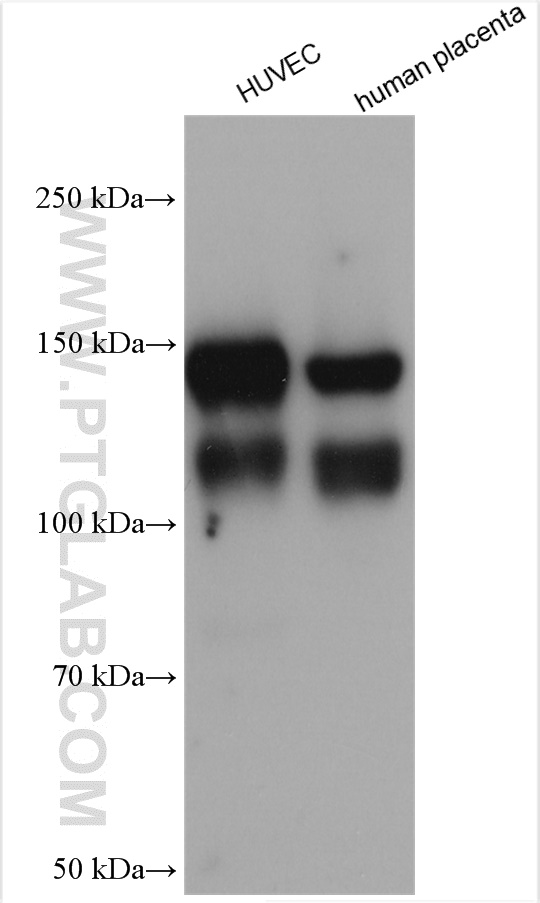 WB analysis using 27956-1-AP