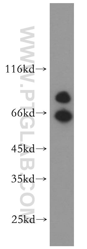 WB analysis of A549 using 13598-1-AP