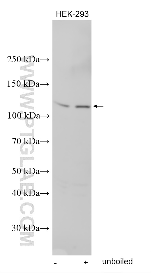 WB analysis using 21737-1-AP