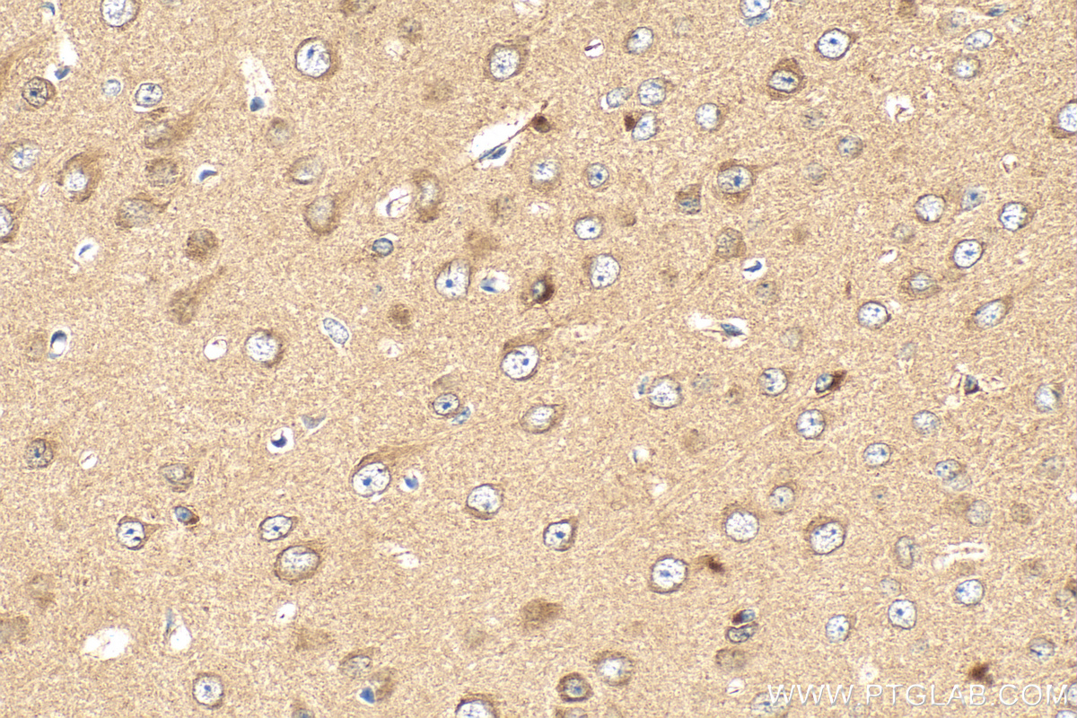 IHC staining of mouse brain using 22465-1-AP