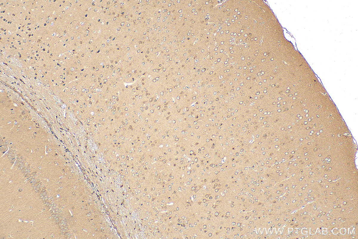 IHC staining of mouse brain using 22465-1-AP