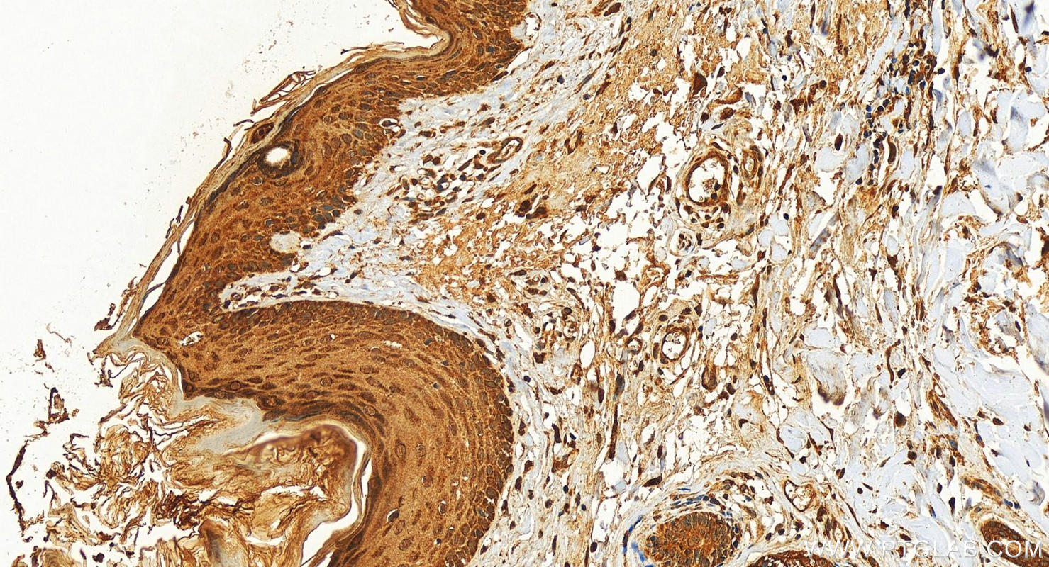 IHC staining of human paracancerous tissue of skin using 10762-1-AP