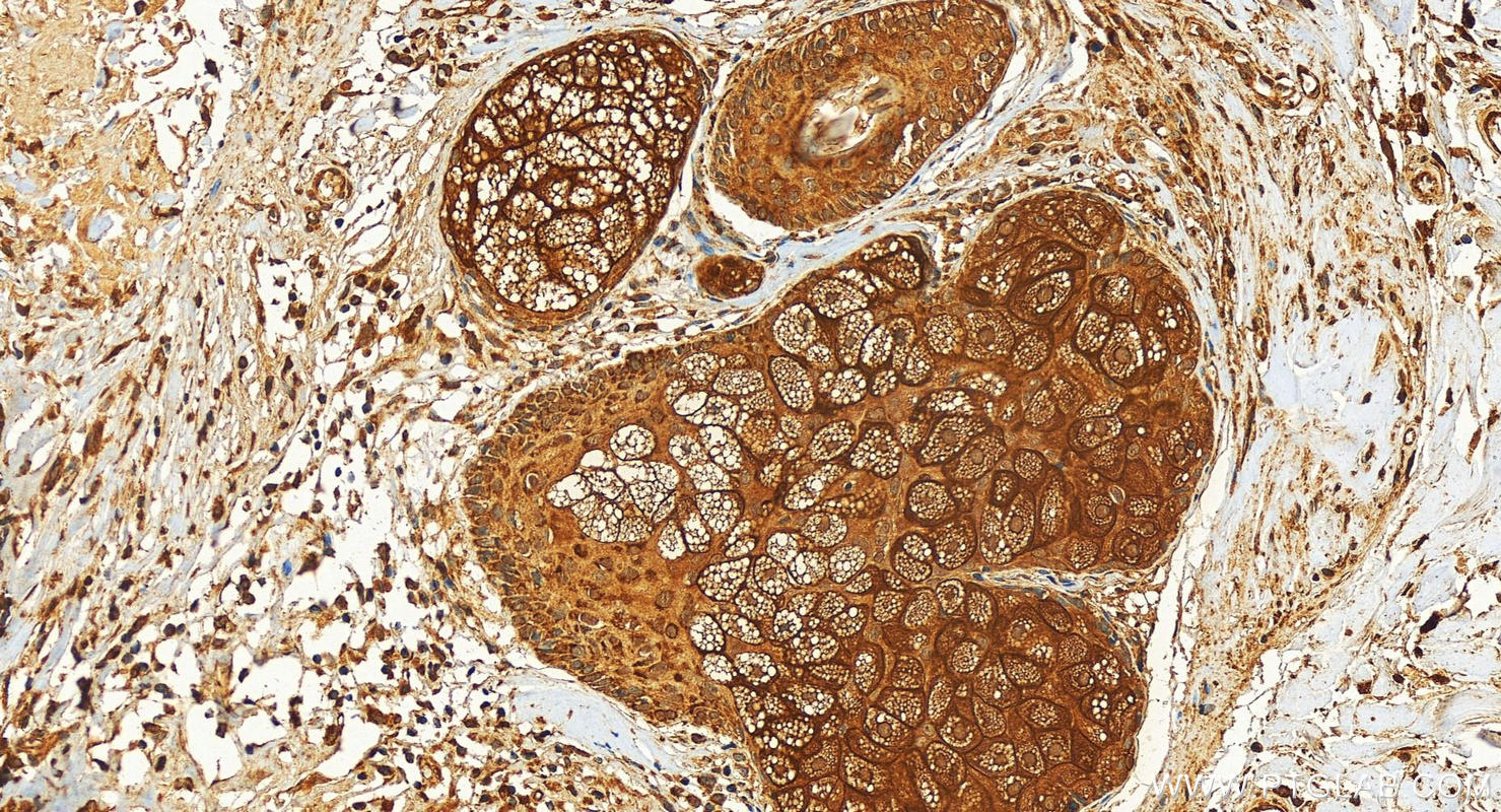 IHC staining of human paracancerous tissue of skin using 10762-1-AP