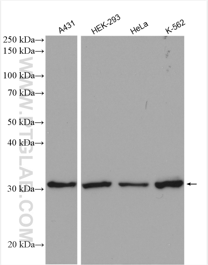 WB analysis using 65182-1-Ig