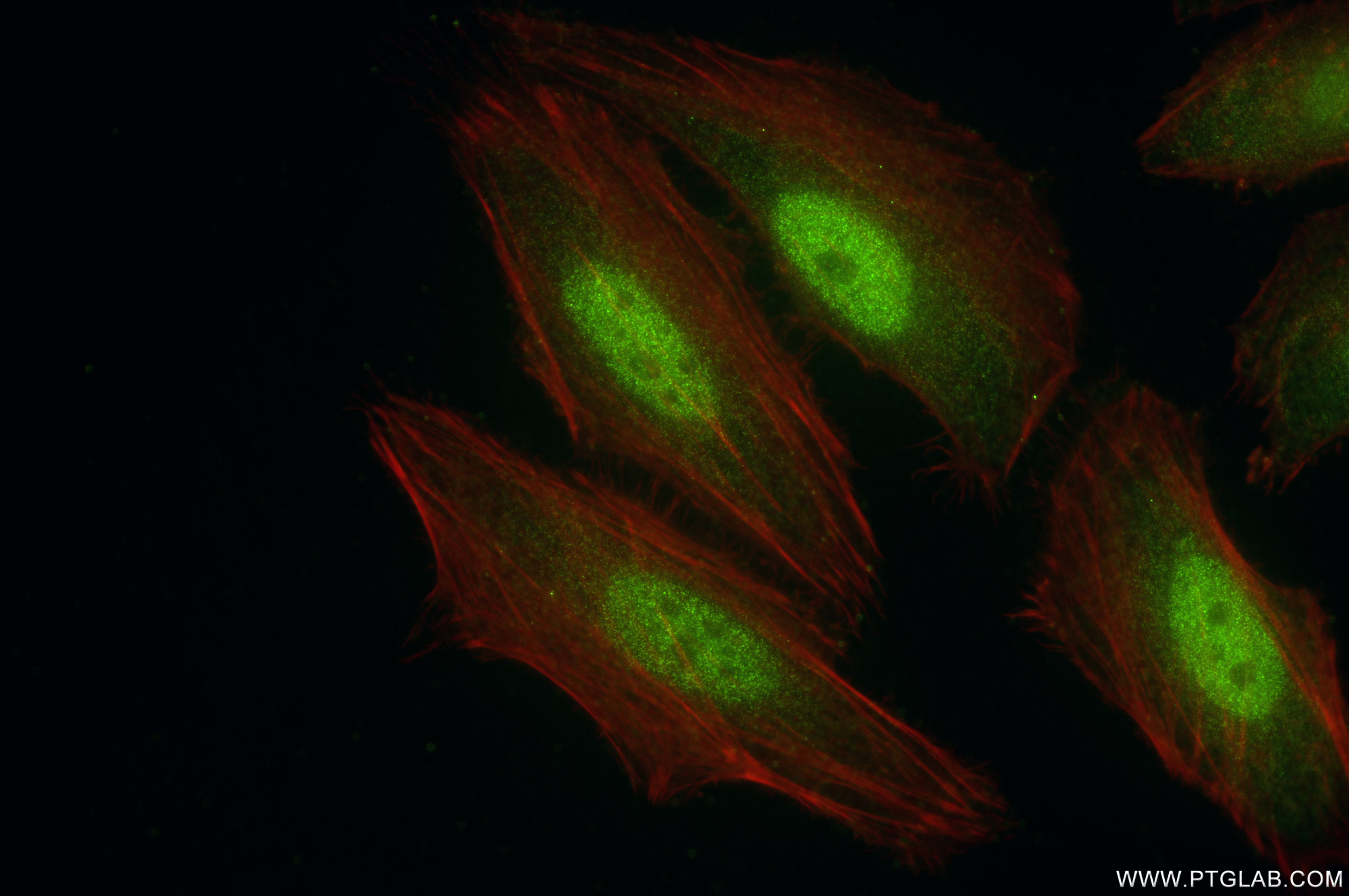IF Staining of HeLa using 84271-1-RR (same clone as 84271-1-PBS)