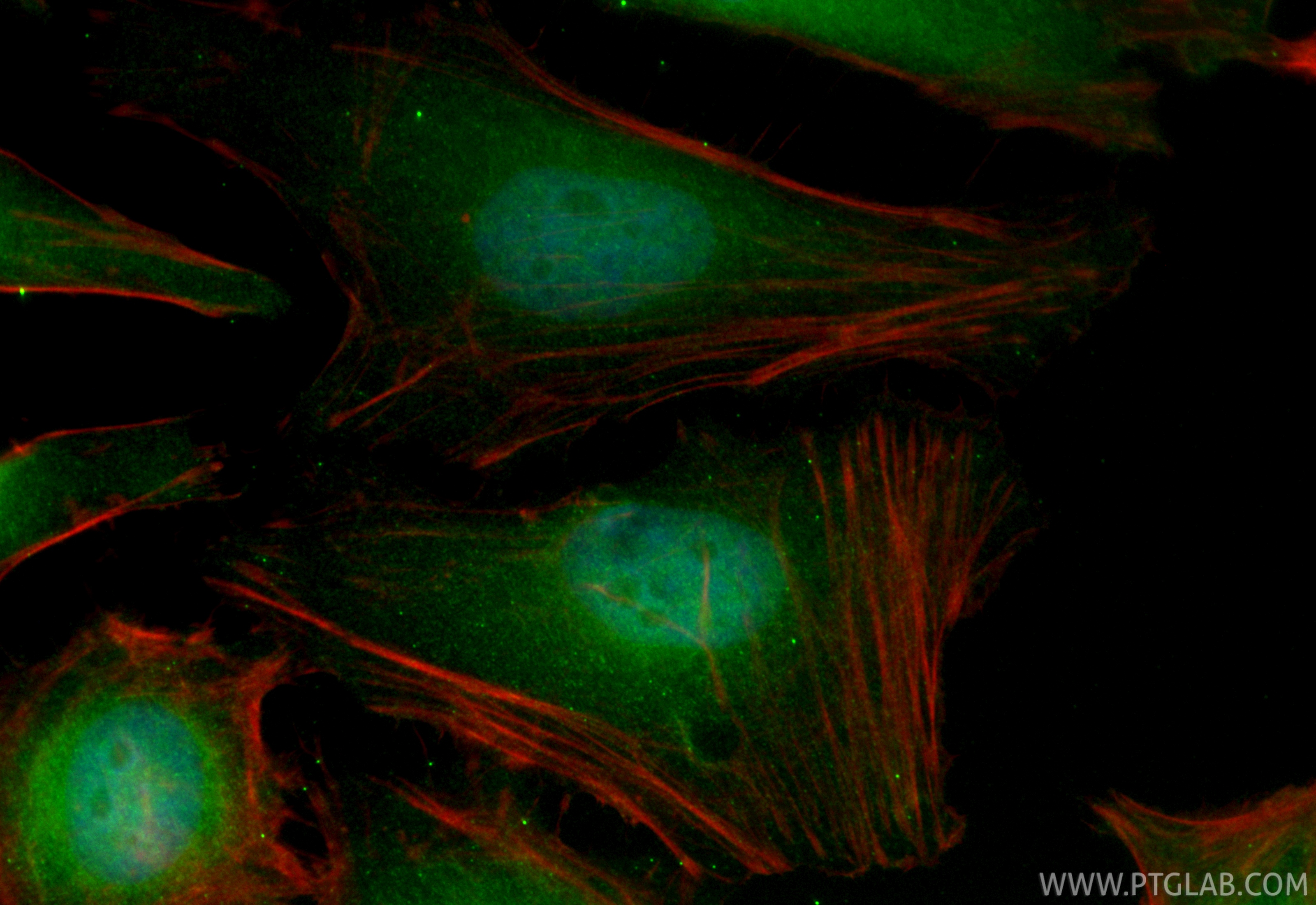 IF Staining of HeLa using CL488-84271