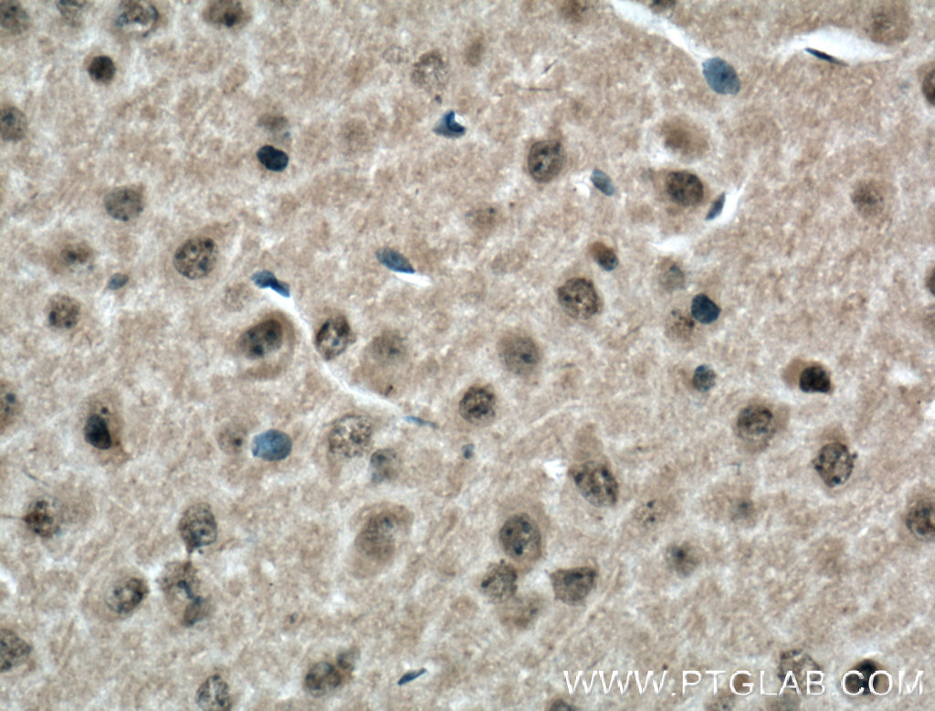IHC staining of mouse brain using 17182-1-AP