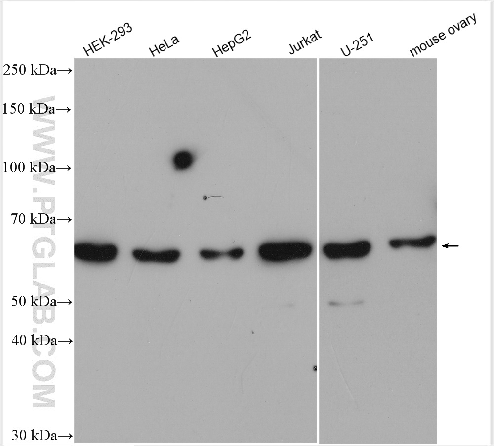 CDK17