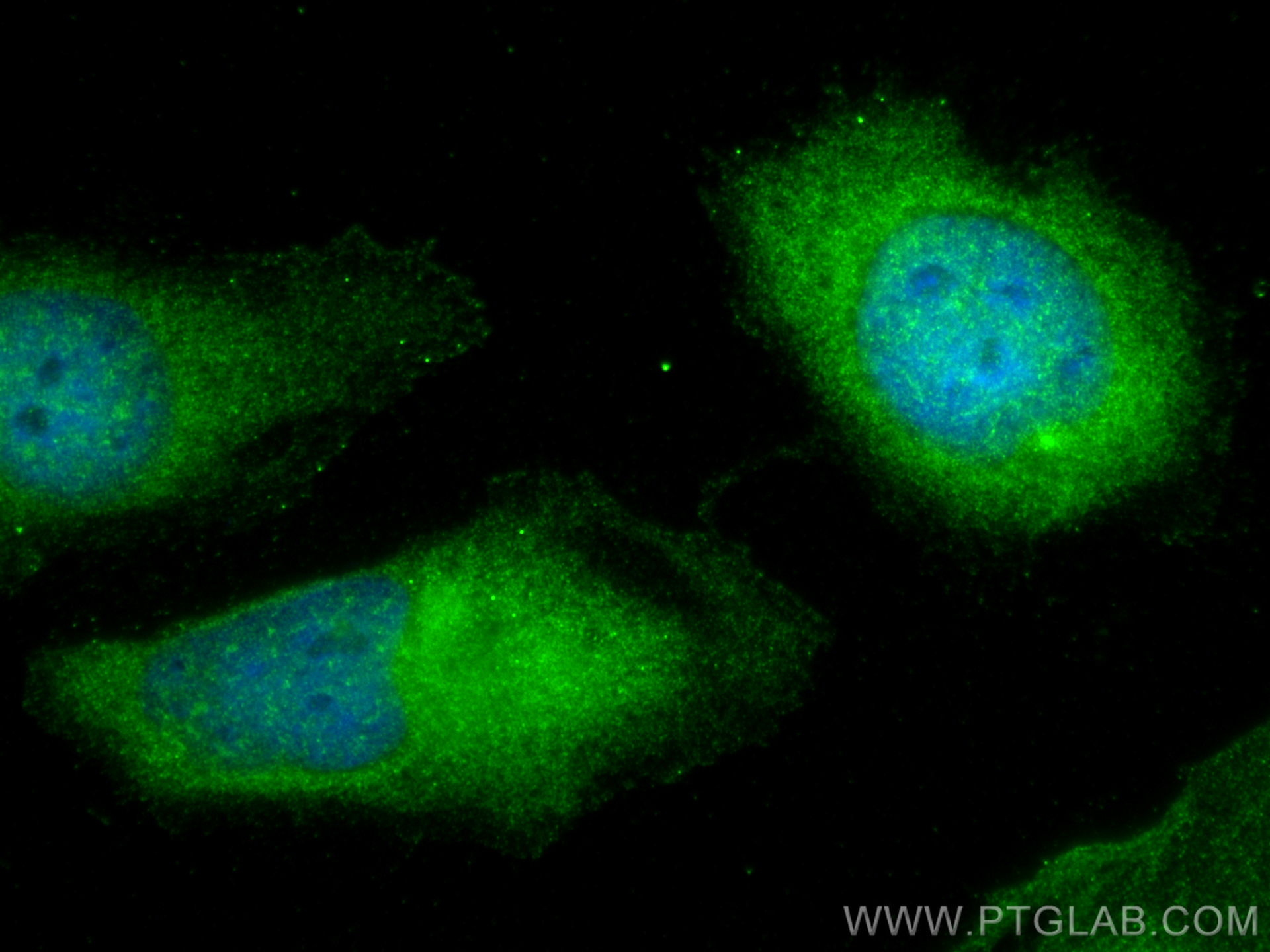 IF Staining of HeLa using 10122-1-AP