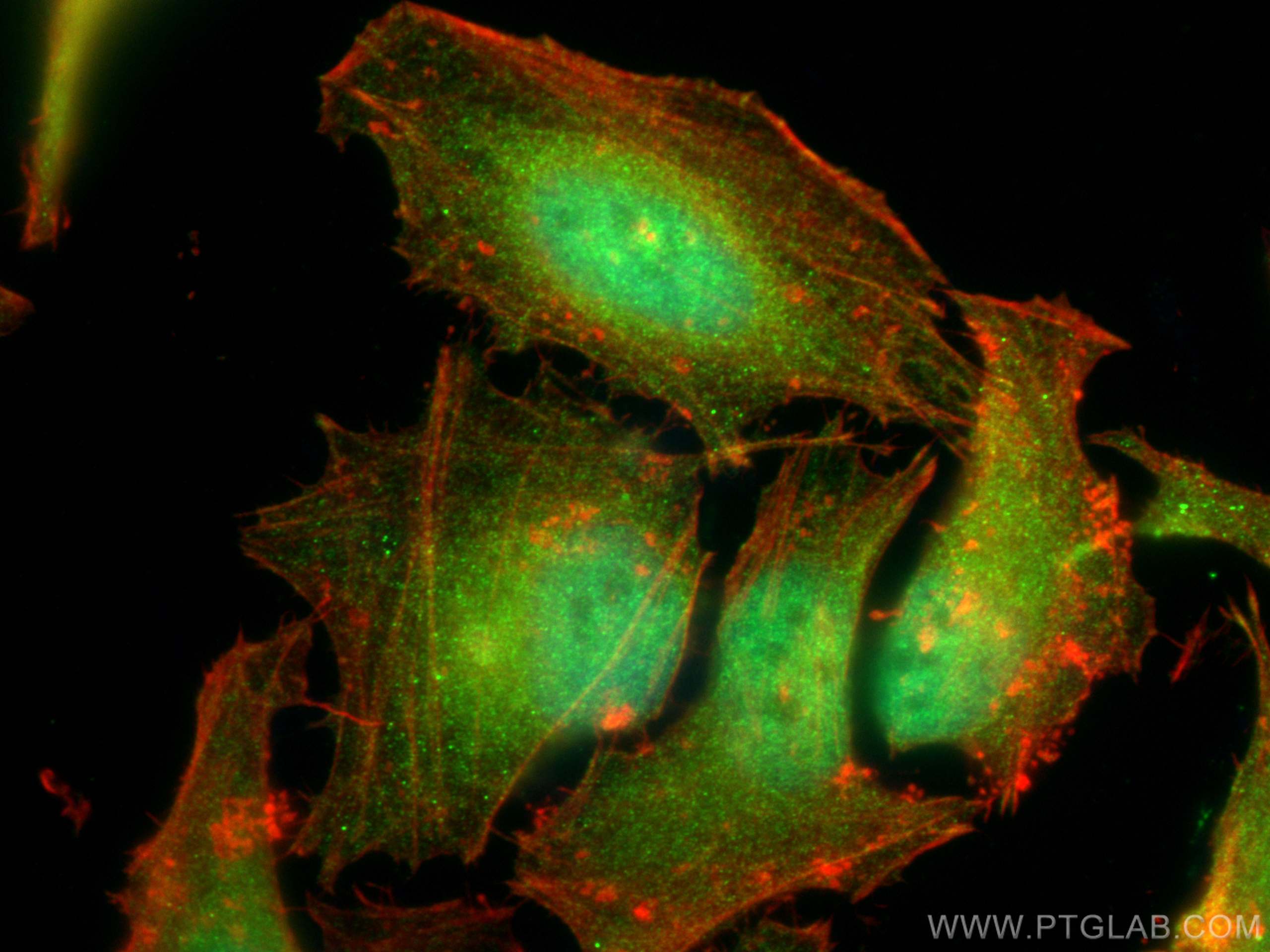 IF Staining of HeLa using 22060-1-AP