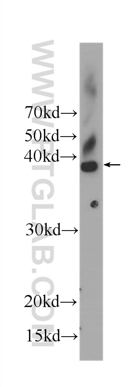 CDK2 Monoclonal antibody