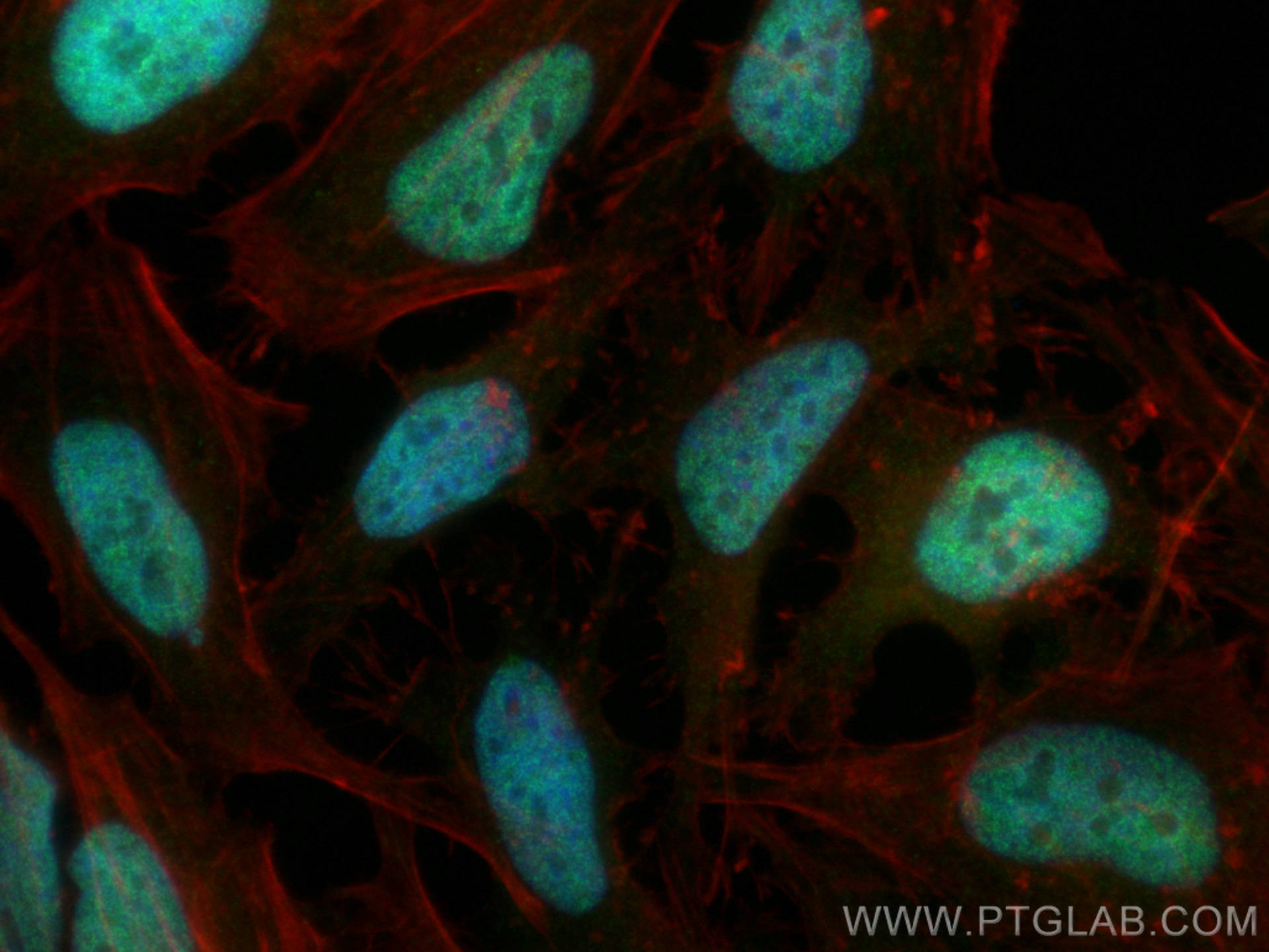 IF Staining of HeLa using 13060-2-AP