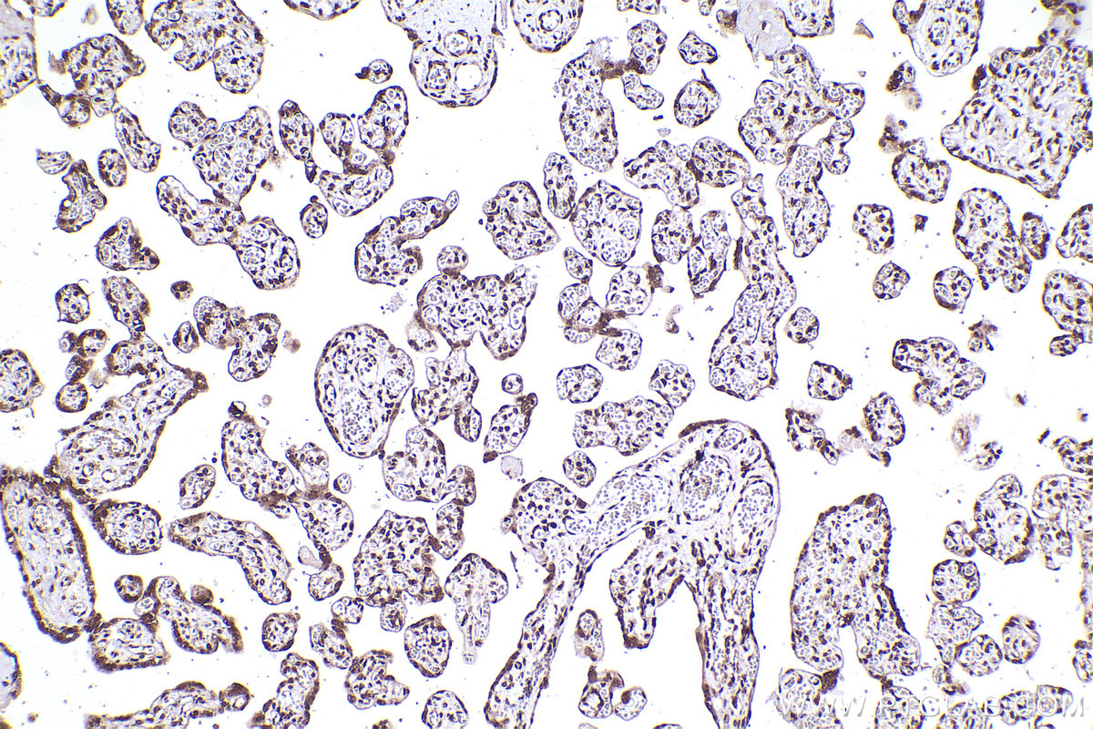Immunohistochemical analysis of paraffin-embedded human placenta tissue slide using 13060-2-AP (CDK2AP1 antibody) at dilution of 1:1000 (under 10x lens). Heat mediated antigen retrieval with Tris-EDTA buffer (pH 9.0). IHC staining of human placenta using 13060-2-AP