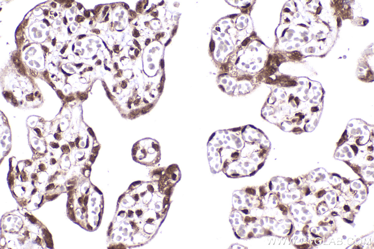 Immunohistochemical analysis of paraffin-embedded human placenta tissue slide using 13060-2-AP (CDK2AP1 antibody) at dilution of 1:1000 (under 40x lens). Heat mediated antigen retrieval with Tris-EDTA buffer (pH 9.0). IHC staining of human placenta using 13060-2-AP