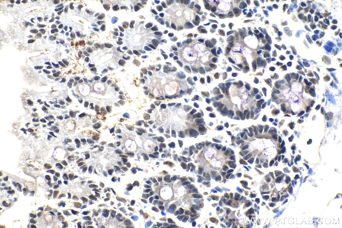 IHC staining of mouse intestine using 15423-1-AP