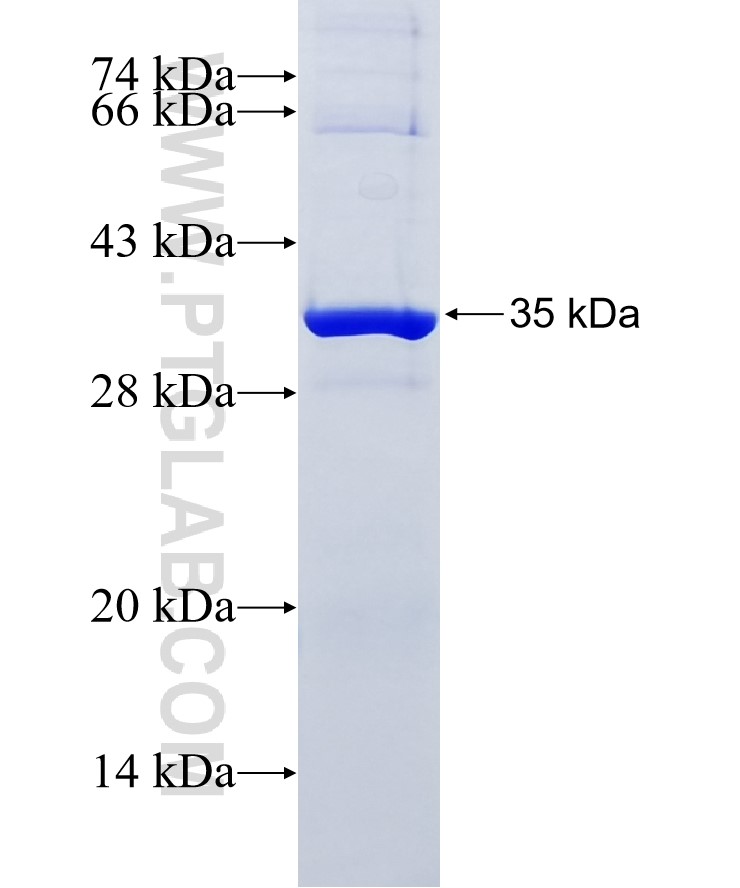 CDK4 fusion protein Ag20538 SDS-PAGE