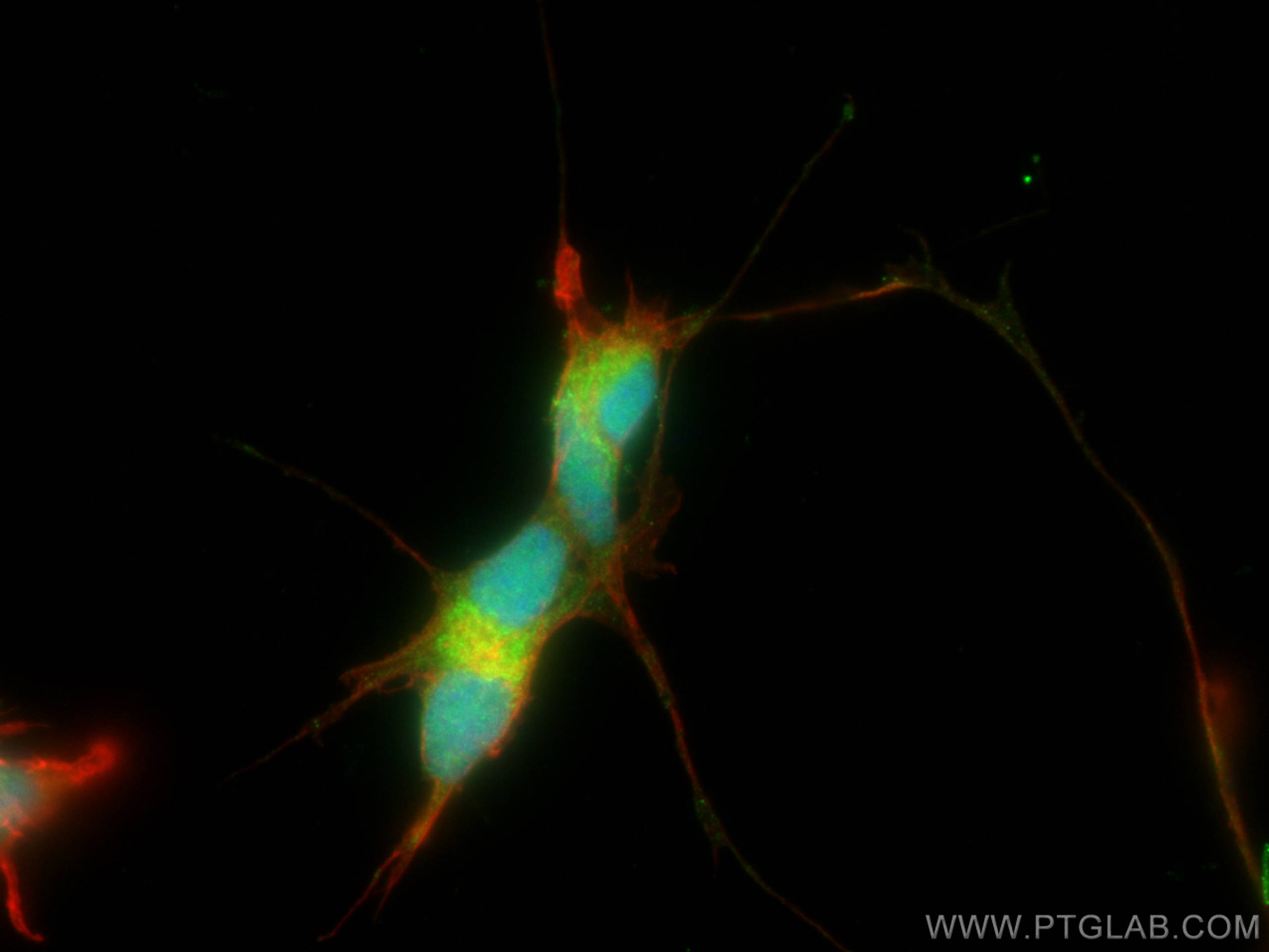 IF Staining of SH-SY5Y using 10430-1-AP