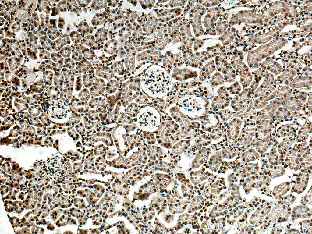 IHC staining of mouse kidney using 10430-1-AP