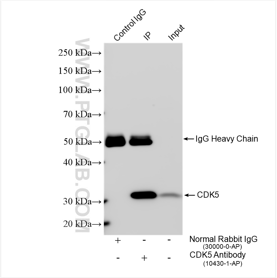 IP experiment of mouse brain using 10430-1-AP