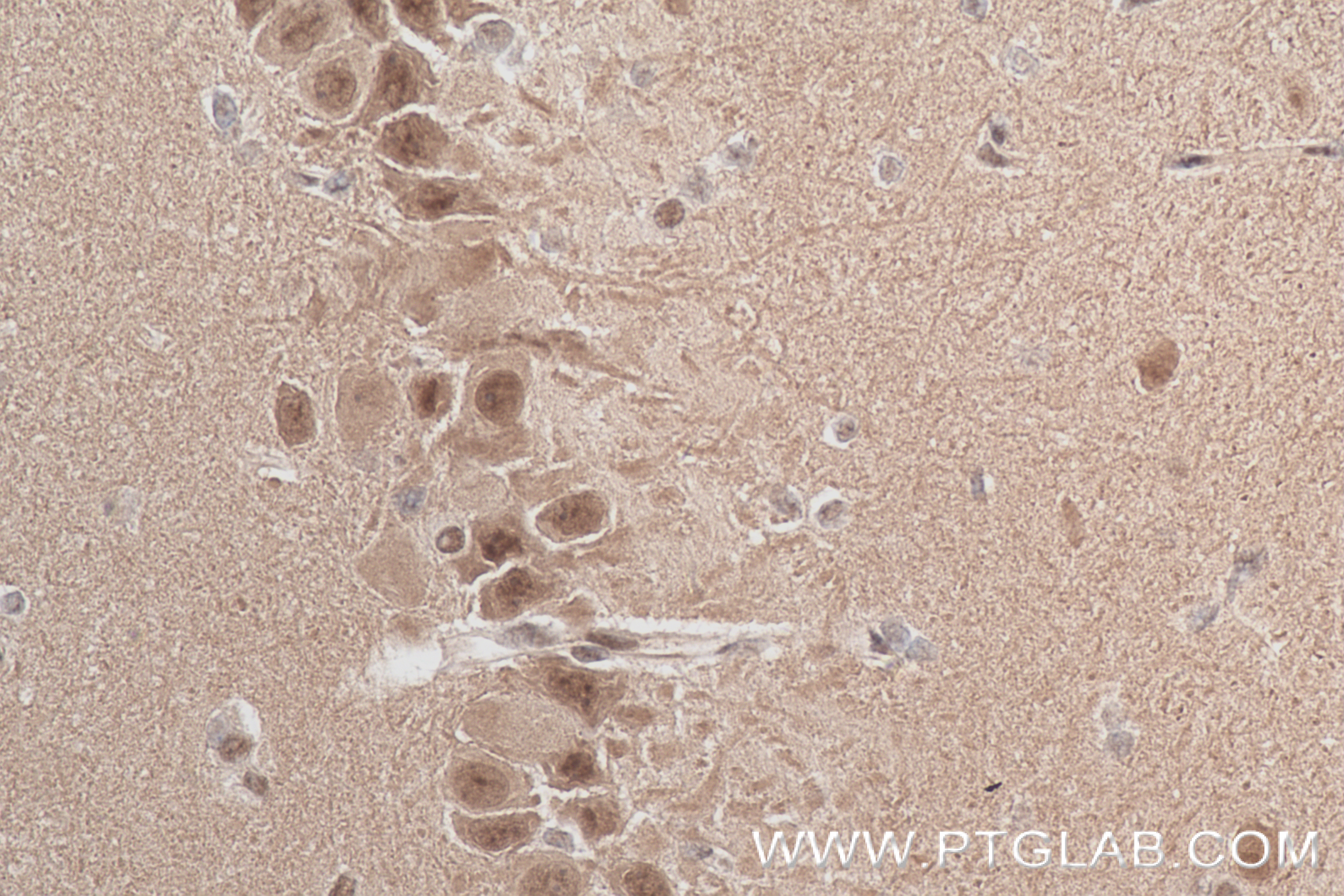IHC staining of rat brain using 84749-1-RR