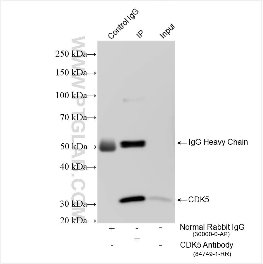 IP experiment of mouse brain using 84749-1-RR (same clone as 84749-1-PBS)
