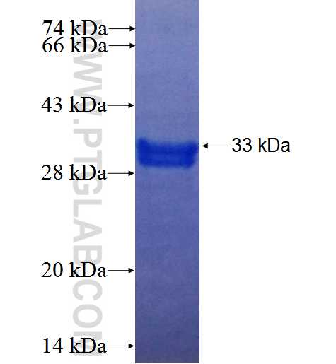 CDK5R2 fusion protein Ag25834 SDS-PAGE