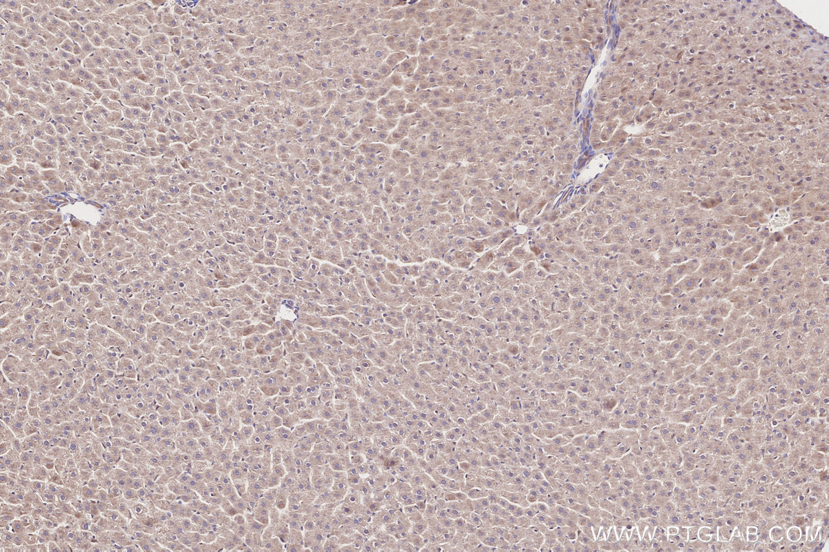 IHC staining of rat liver using 31702-1-AP IHC staining of rat liver using 31702-1-AP