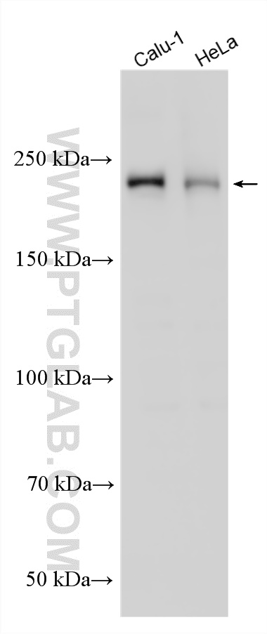 WB analysis using 31702-1-AP (same clone as 31702-1-PBS) WB analysis using 31702-1-AP (same clone as 31702-1-PBS)