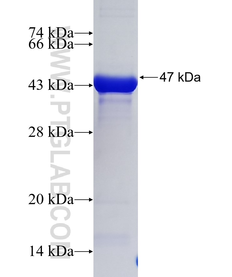 CDK5RAP2 fusion protein Ag36245 SDS-PAGE