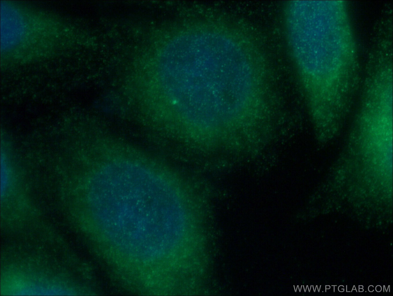 IF Staining of HepG2 using 11007-1-AP