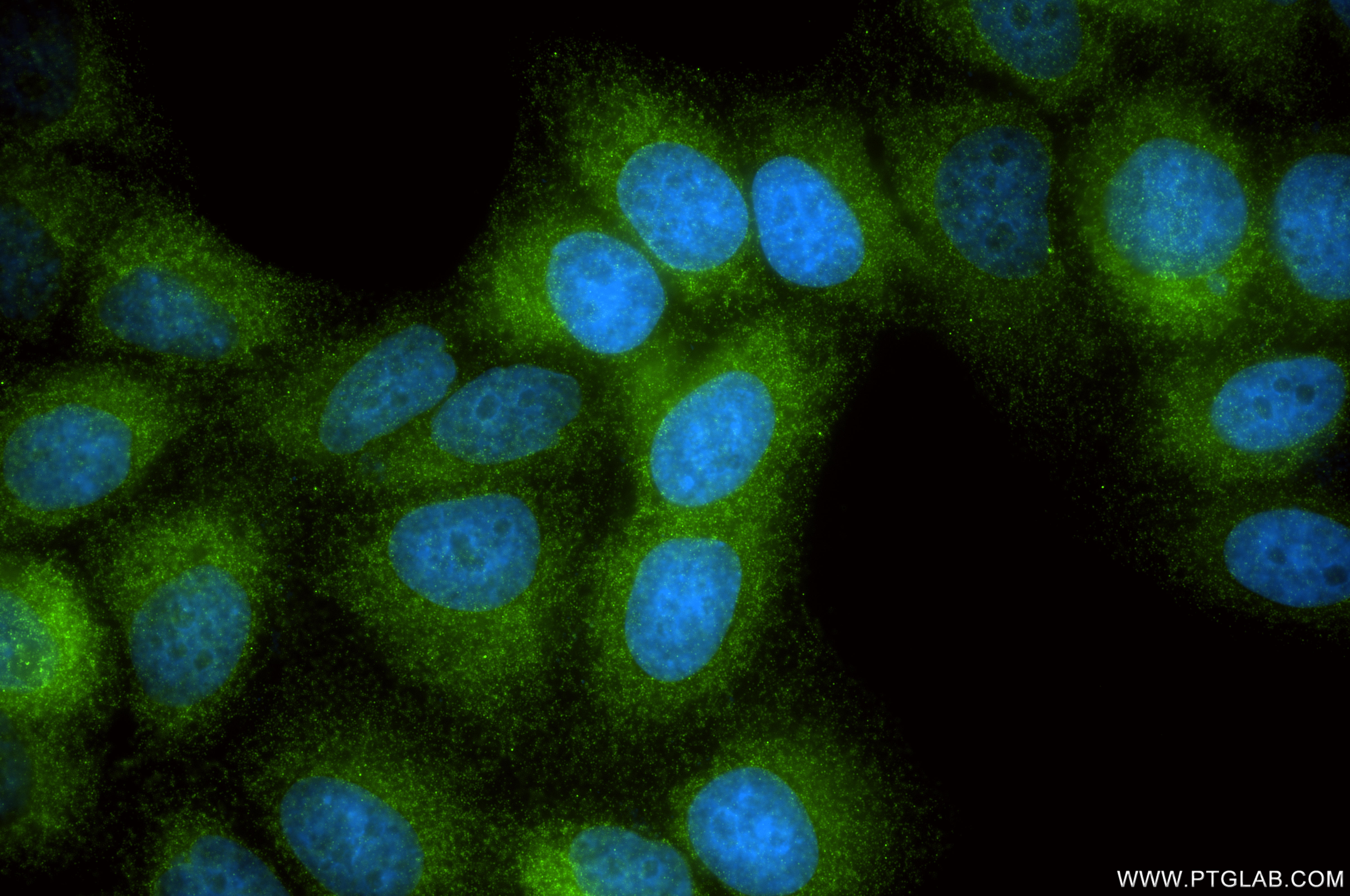IF Staining of HepG2 using 86177-2-RR