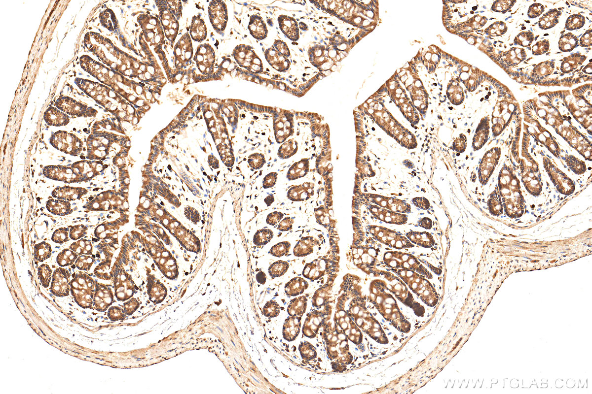 IHC staining of mouse colon using 14052-1-AP