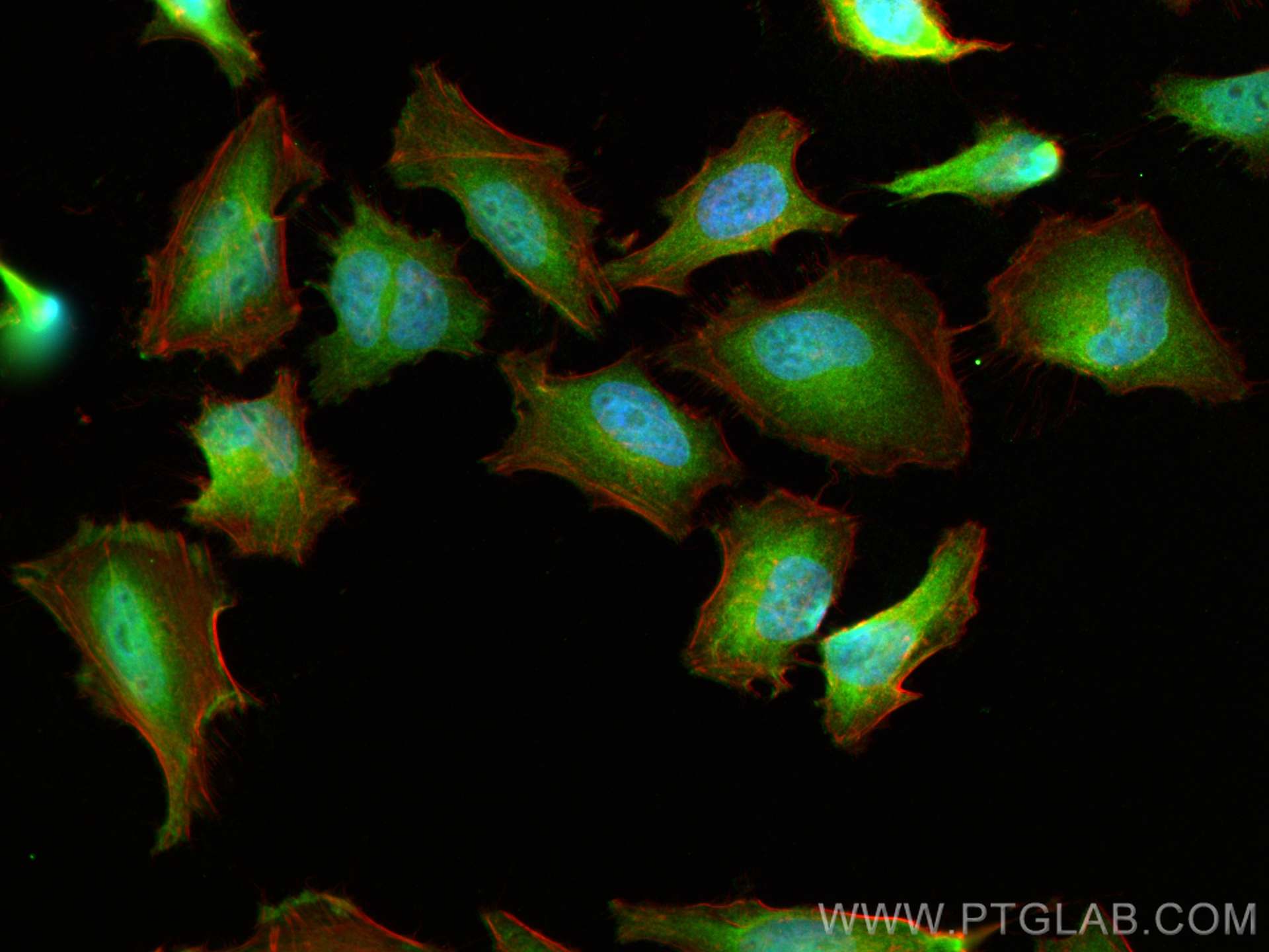 IF Staining of HeLa using 19117-1-AP