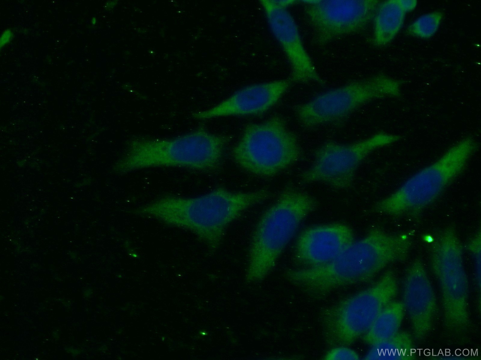 IF Staining of HeLa using 66278-1-Ig (same clone as 66278-1-PBS)