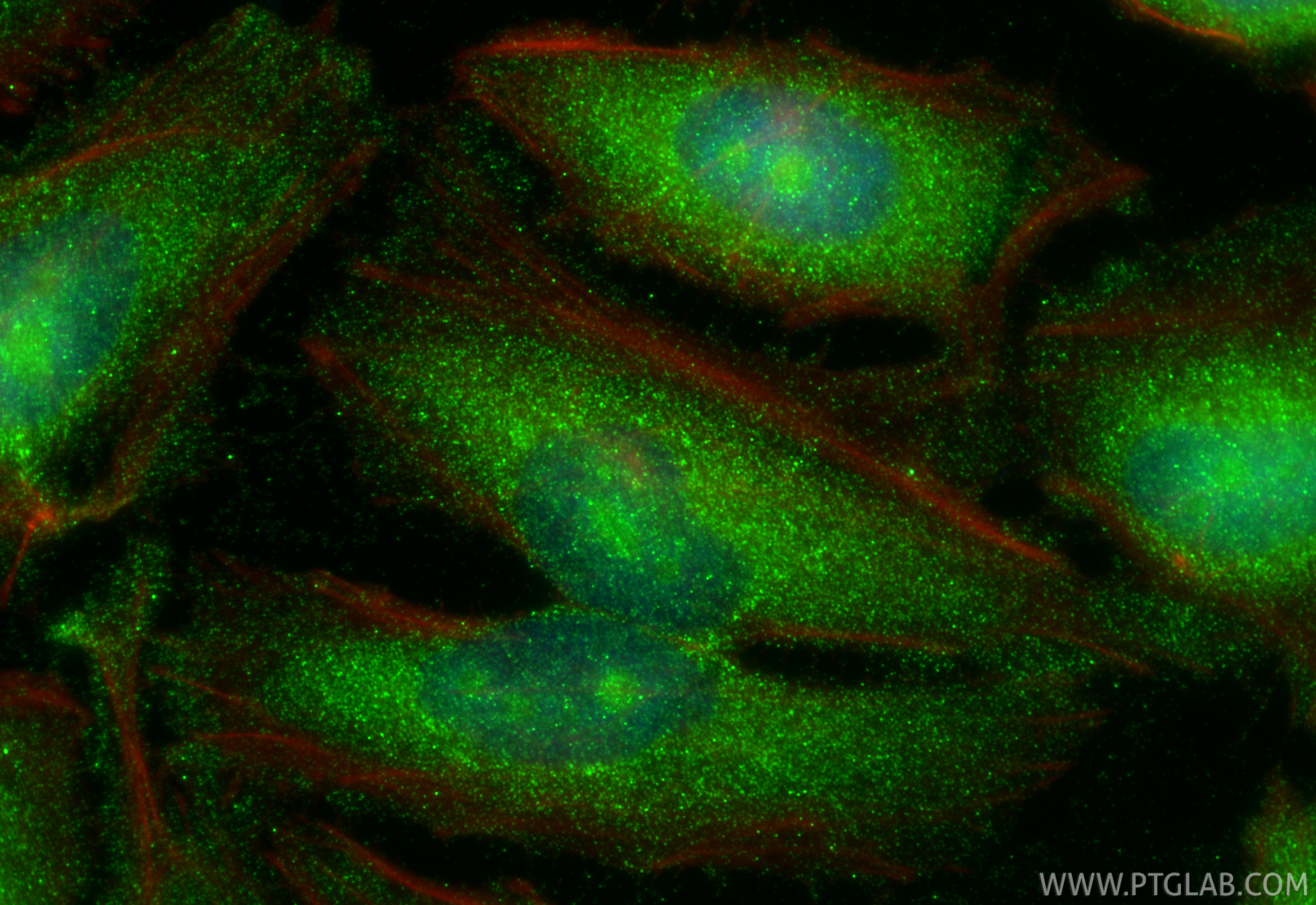 IF Staining of HeLa using 66278-1-Ig