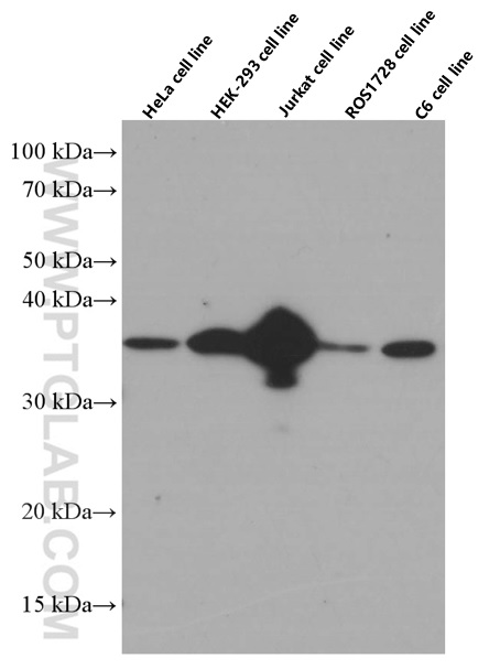 CDK6 Monoclonal antibody