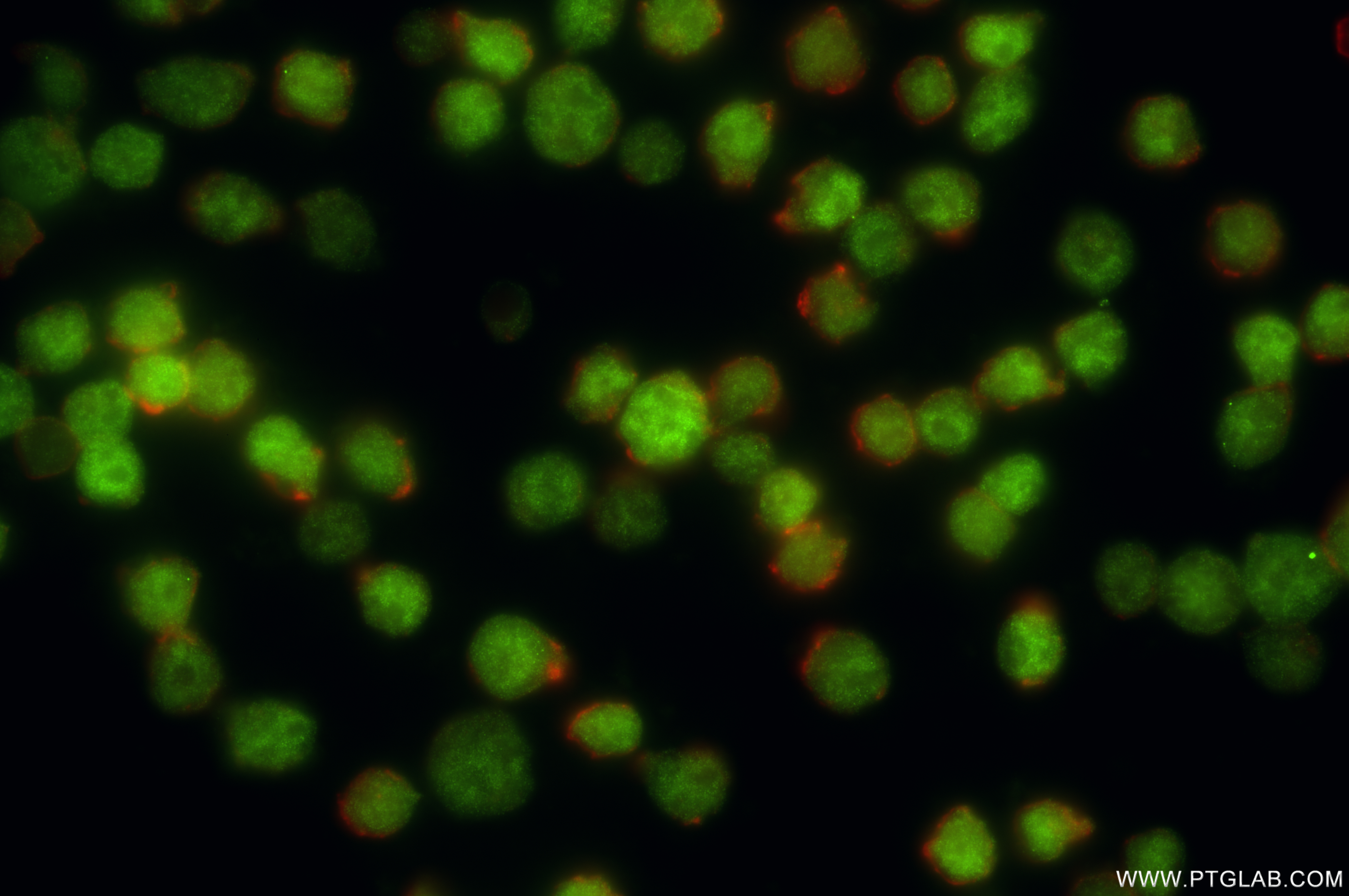 IF Staining of Jurkat using 84200-1-RR (same clone as 84200-1-PBS)