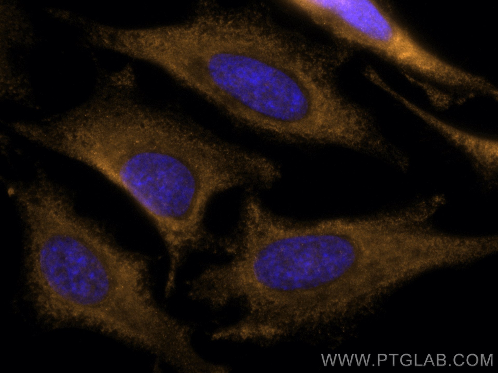 IF Staining of HeLa using CL555-66278