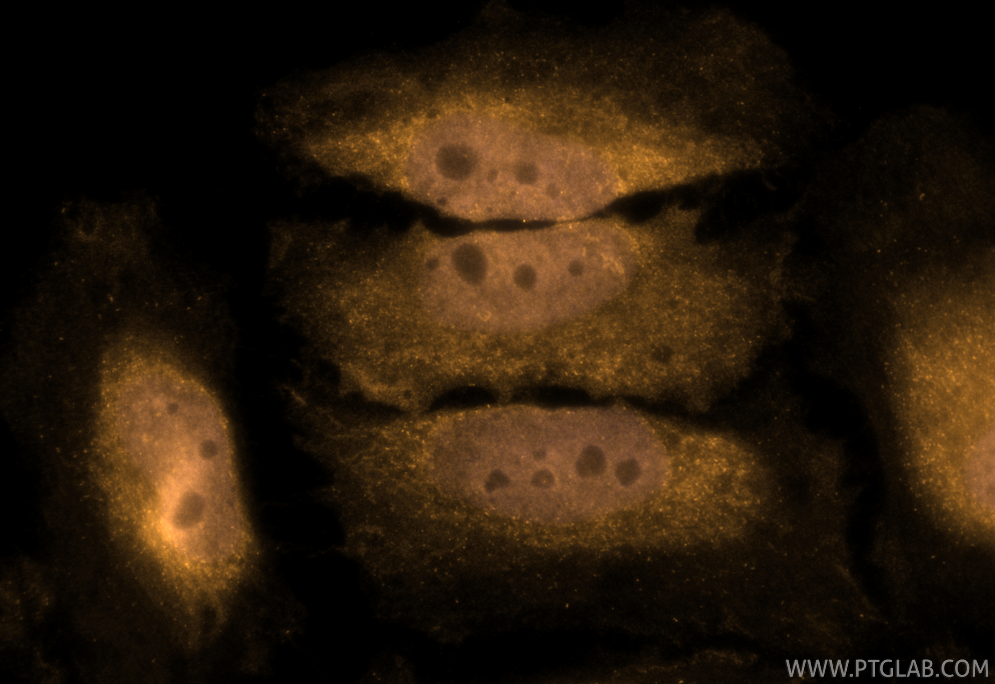 IF Staining of HeLa using CL555-66278 IF Staining of HeLa using CL555-66278