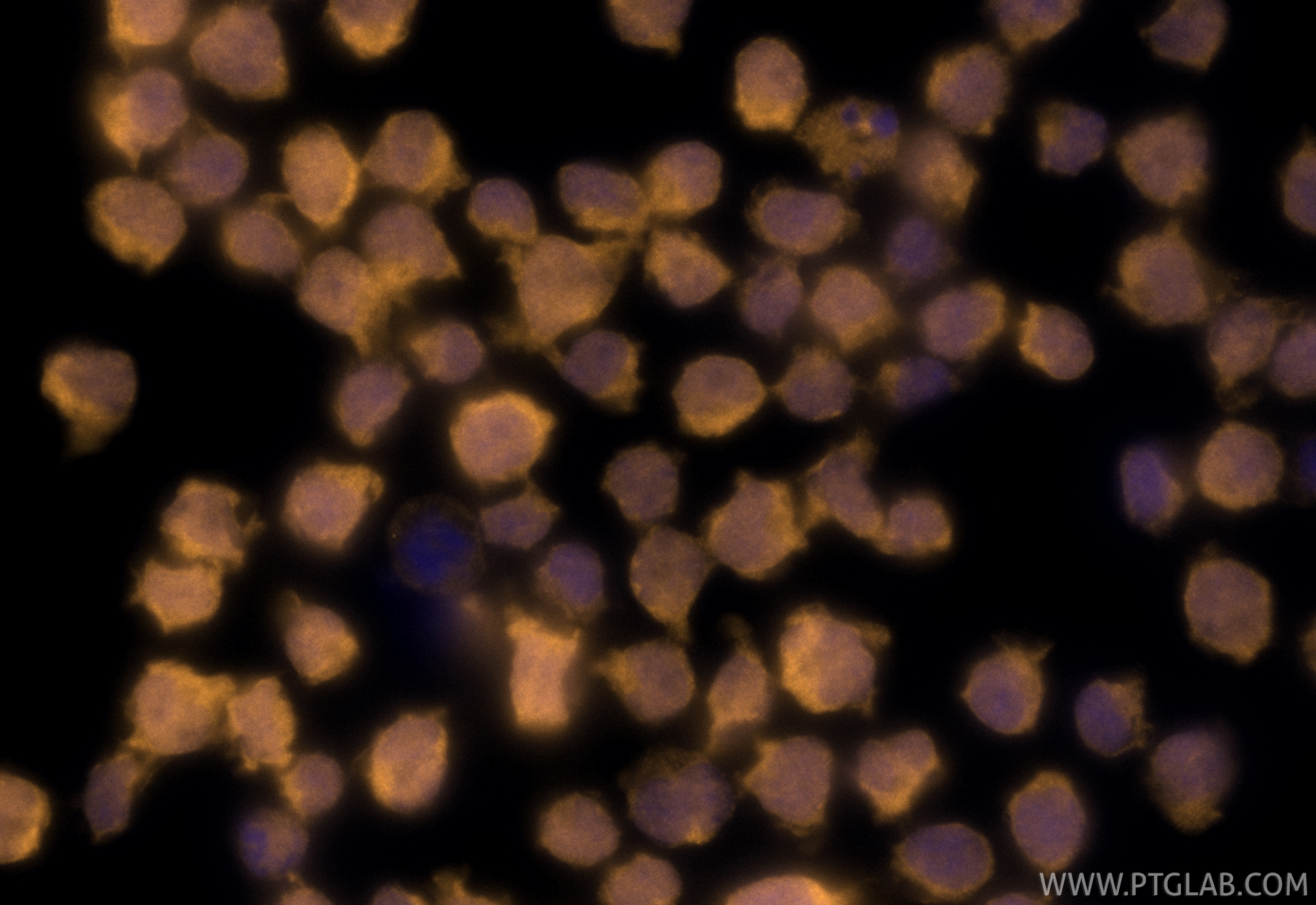 IF Staining of Jurkat using CL555-66278